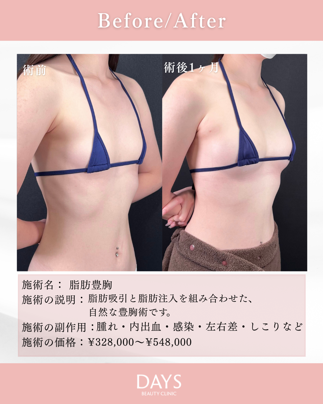 スライド10